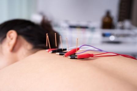 Electroacupuncture